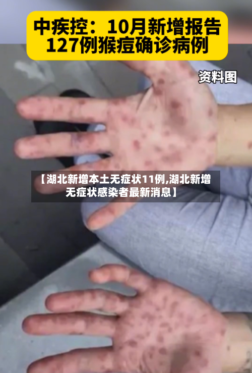 【湖北新增本土无症状11例,湖北新增无症状感染者最新消息】-第2张图片