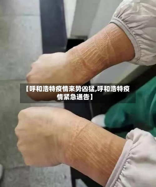 【呼和浩特疫情来势凶猛,呼和浩特疫情紧急通告】