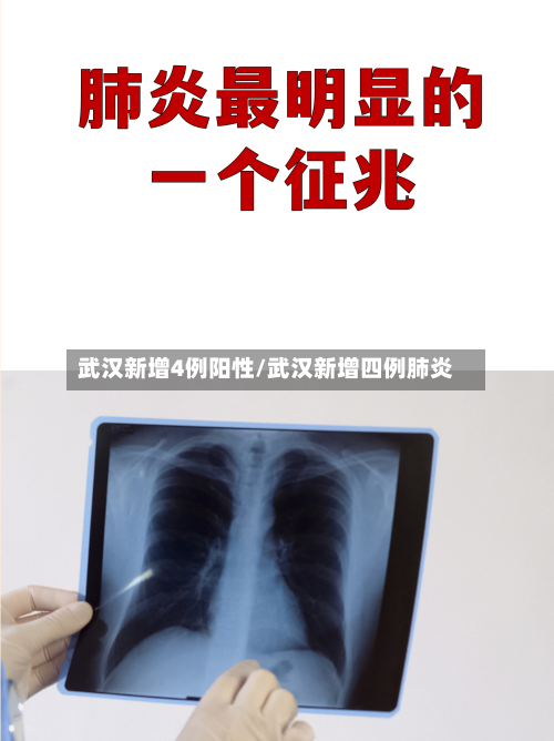 武汉新增4例阳性/武汉新增四例肺炎-第3张图片