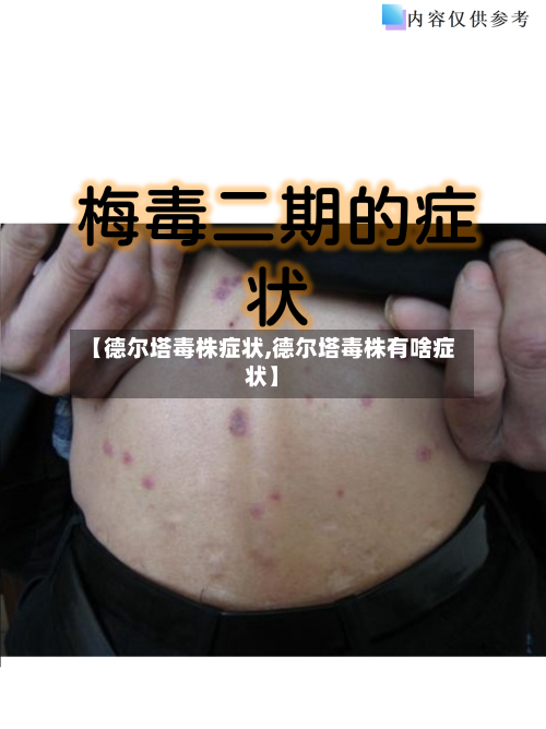 【德尔塔毒株症状,德尔塔毒株有啥症状】