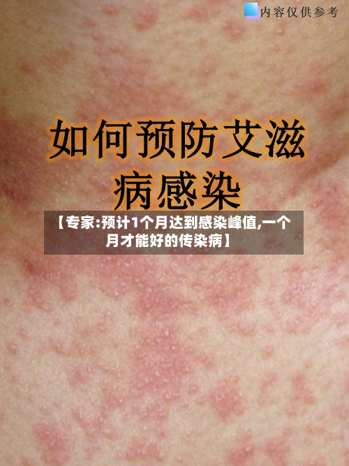 【专家:预计1个月达到感染峰值,一个月才能好的传染病】