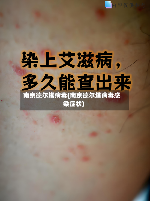 南京德尔塔病毒(南京德尔塔病毒感染症状)-第2张图片