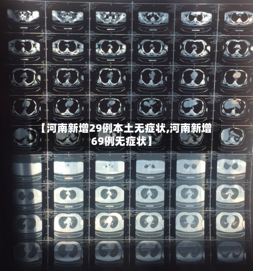 【河南新增29例本土无症状,河南新增69例无症状】-第2张图片