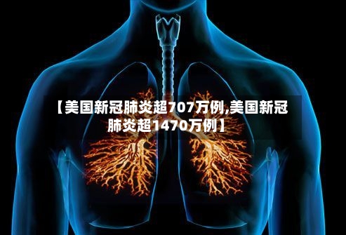 【美国新冠肺炎超707万例,美国新冠肺炎超1470万例】
