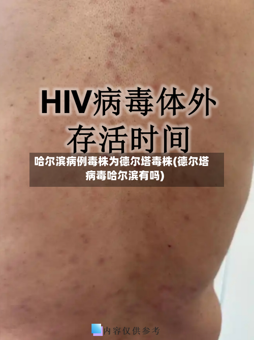 哈尔滨病例毒株为德尔塔毒株(德尔塔病毒哈尔滨有吗)