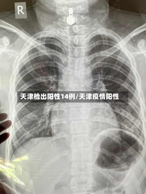 天津检出阳性14例/天津疫情阳性-第3张图片
