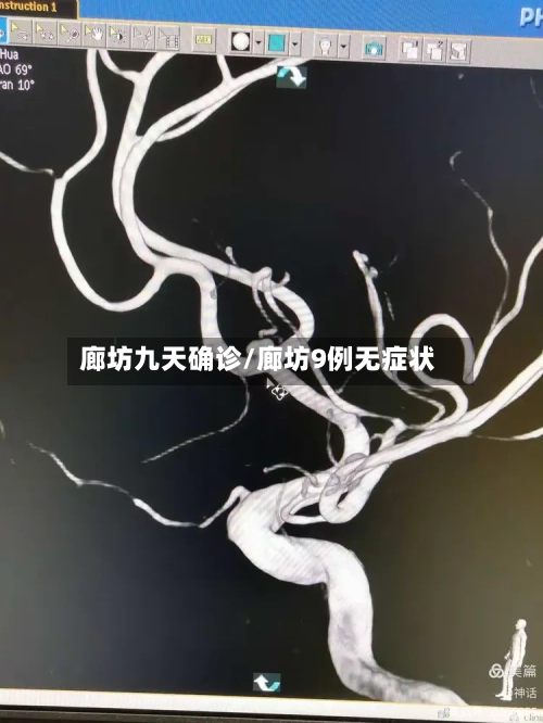 廊坊九天确诊/廊坊9例无症状-第3张图片