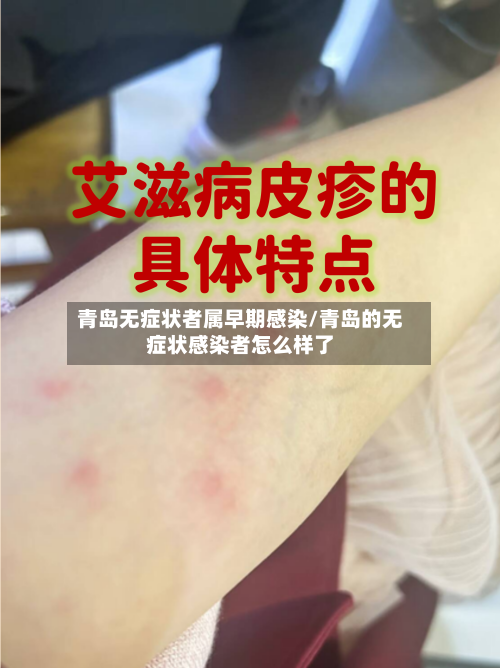 青岛无症状者属早期感染/青岛的无症状感染者怎么样了
