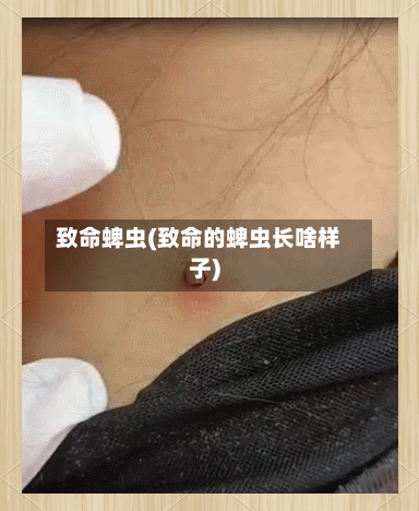 致命蜱虫(致命的蜱虫长啥样子)