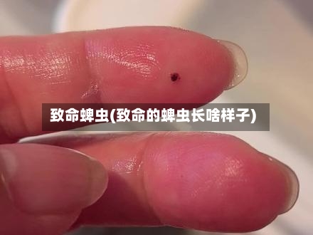 致命蜱虫(致命的蜱虫长啥样子)-第3张图片