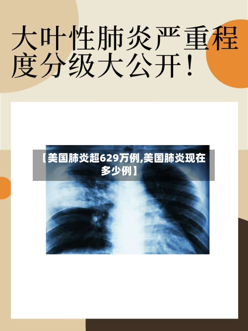 【美国肺炎超629万例,美国肺炎现在多少例】-第2张图片