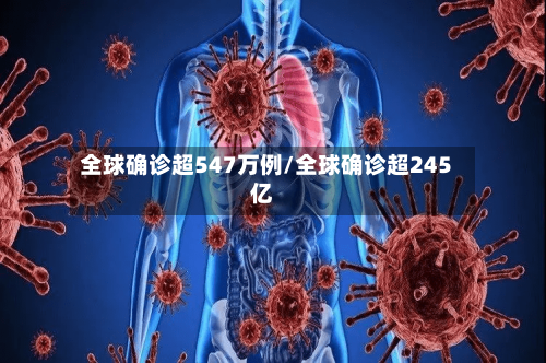 全球确诊超547万例/全球确诊超245亿-第3张图片