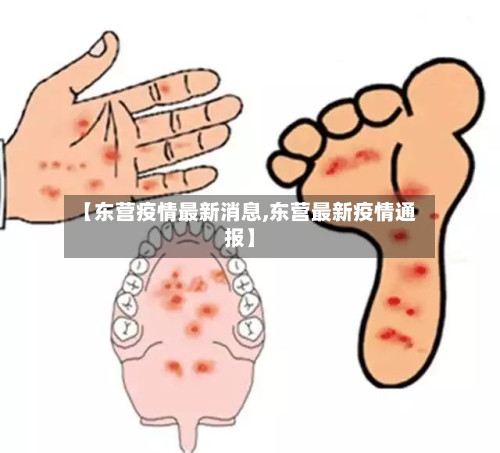 【东营疫情最新消息,东营最新疫情通报】-第2张图片