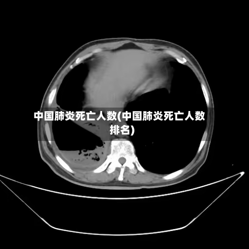 中国肺炎死亡人数(中国肺炎死亡人数排名)