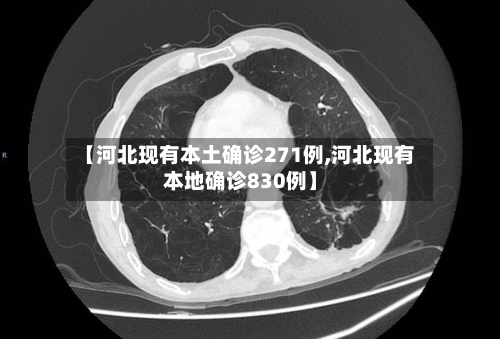 【河北现有本土确诊271例,河北现有本地确诊830例】-第2张图片