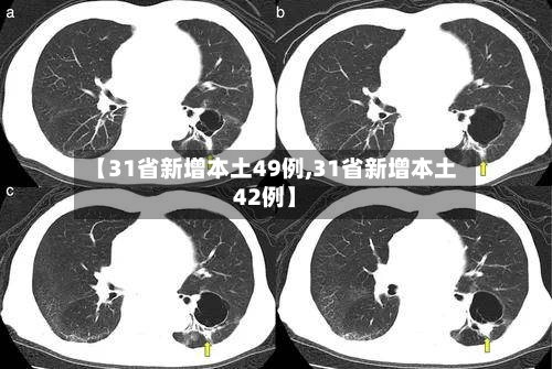 【31省新增本土49例,31省新增本土42例】-第2张图片