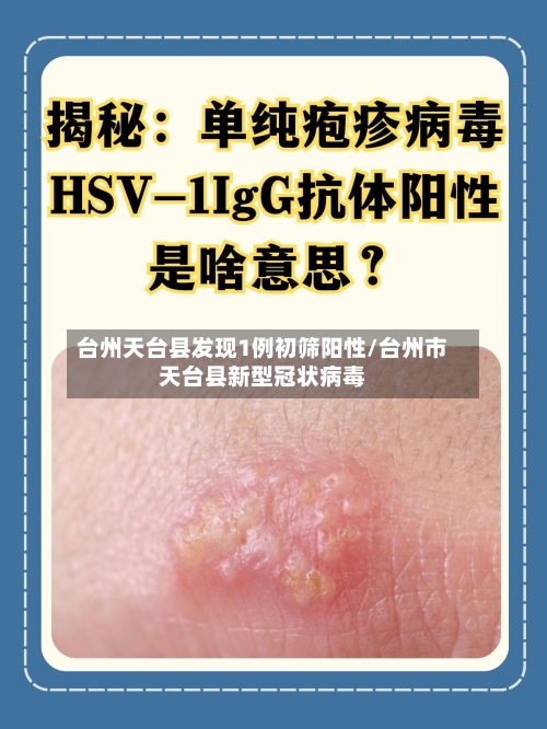 台州天台县发现1例初筛阳性/台州市天台县新型冠状病毒-第3张图片