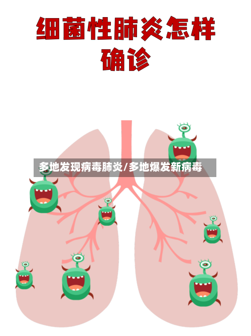 多地发现病毒肺炎/多地爆发新病毒-第2张图片