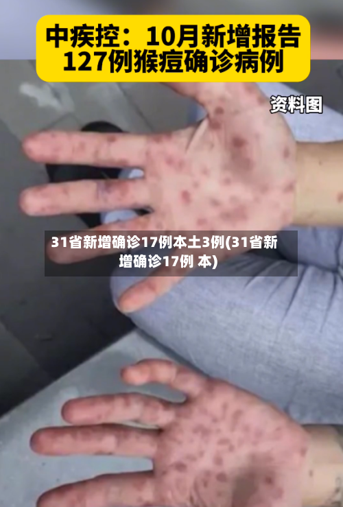 31省新增确诊17例本土3例(31省新增确诊17例 本)