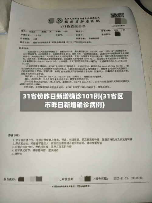 31省份昨日新增确诊101例(31省区市昨日新增确诊病例)-第3张图片
