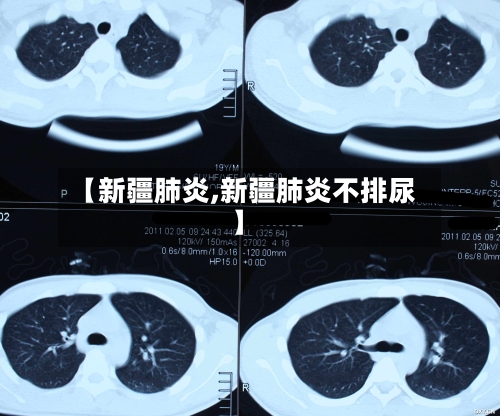 【新疆肺炎,新疆肺炎不排尿】