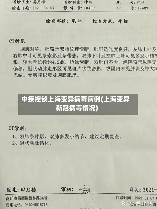 中疾控谈上海变异病毒病例(上海变异新冠病毒情况)-第2张图片