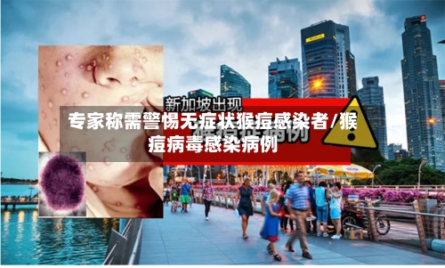 专家称需警惕无症状猴痘感染者/猴痘病毒感染病例-第2张图片