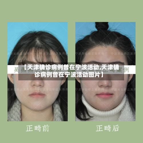 【天津确诊病例曾在宁波活动,天津确诊病例曾在宁波活动图片】