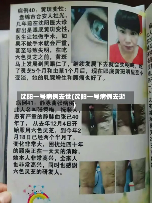 沈阳一号病例去世(沈阳一号病例去逝)