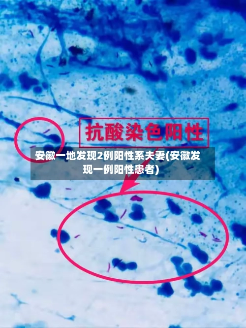 安徽一地发现2例阳性系夫妻(安徽发现一例阳性患者)-第3张图片