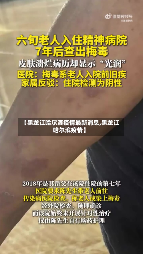 【黑龙江哈尔滨疫情最新消息,黑龙江 哈尔滨疫情】-第3张图片