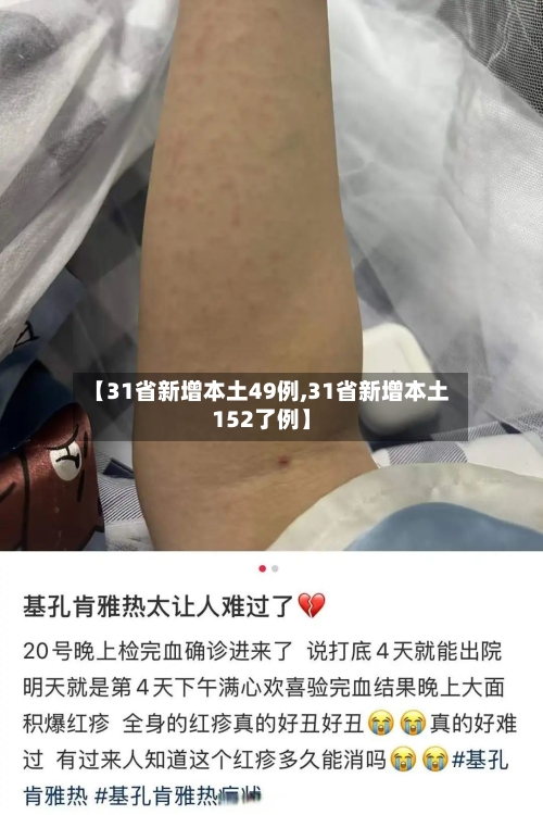 【31省新增本土49例,31省新增本土152了例】-第2张图片