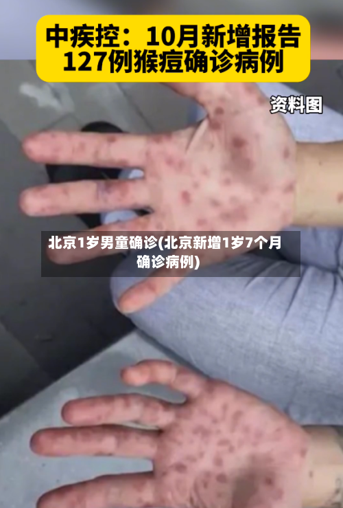 北京1岁男童确诊(北京新增1岁7个月确诊病例)