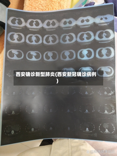 西安确诊新型肺炎(西安新冠确诊病例)-第3张图片