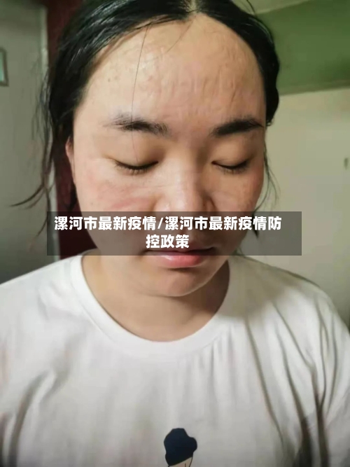 漯河市最新疫情/漯河市最新疫情防控政策