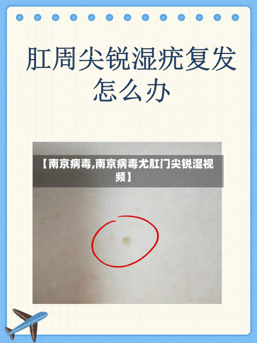 【南京病毒,南京病毒尤肛门尖锐湿视频】-第3张图片
