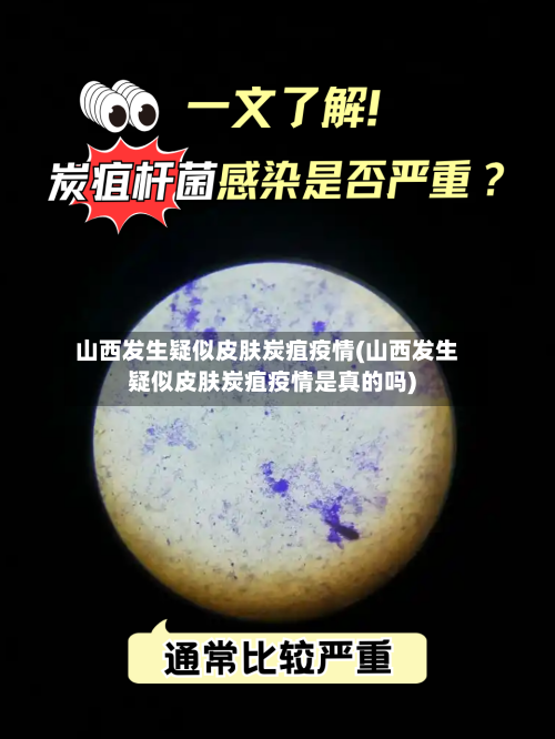 山西发生疑似皮肤炭疽疫情(山西发生疑似皮肤炭疽疫情是真的吗)-第3张图片