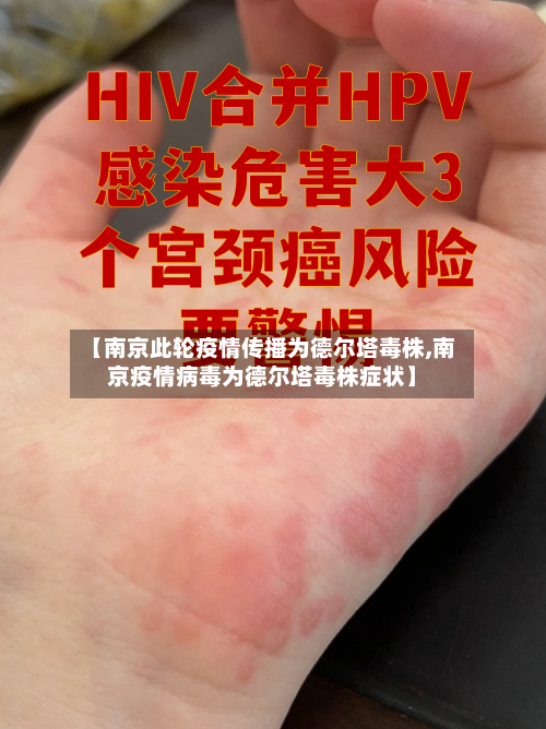 【南京此轮疫情传播为德尔塔毒株,南京疫情病毒为德尔塔毒株症状】-第3张图片