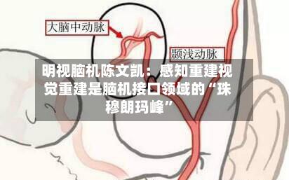 明视脑机陈文凯：感知重建视觉重建是脑机接口领域的“珠穆朗玛峰”