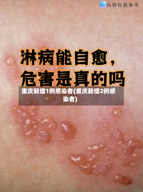 重庆新增1例感染者(重庆新增2例感染者)