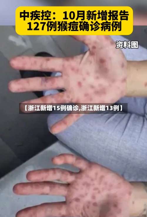 【浙江新增15例确诊,浙江新增13例】