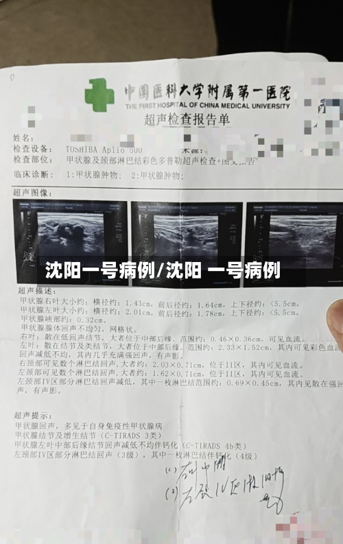 沈阳一号病例/沈阳 一号病例