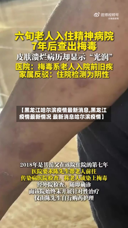 【黑龙江哈尔滨疫情最新消息,黑龙江疫情最新情况 最新消息哈尔滨疫情】-第2张图片