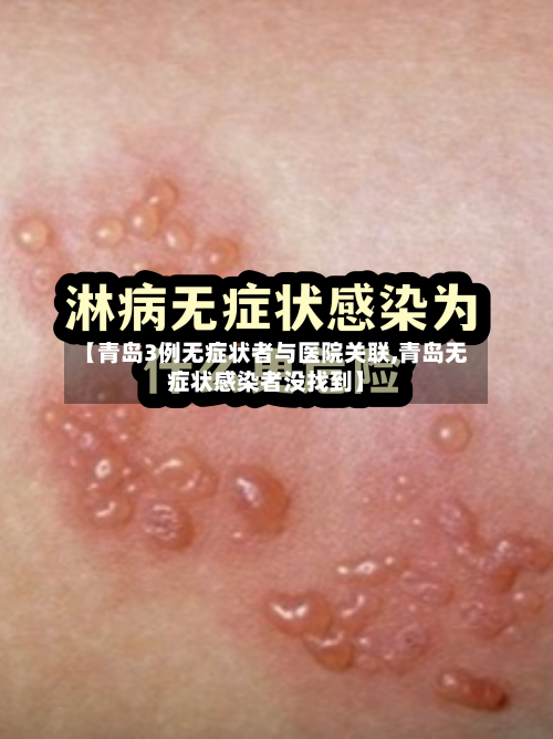 【青岛3例无症状者与医院关联,青岛无症状感染者没找到】-第2张图片