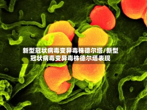 新型冠状病毒变异毒株德尔塔/新型冠状病毒变异毒株德尔塔表现-第2张图片