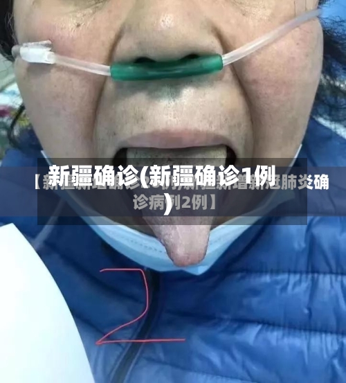 新疆确诊(新疆确诊1例)-第2张图片
