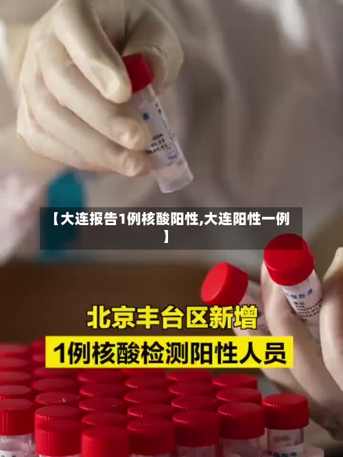 【大连报告1例核酸阳性,大连阳性一例】-第2张图片