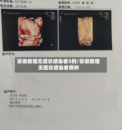 安徽新增无症状感染者5例/安徽新增无症状感染者病例