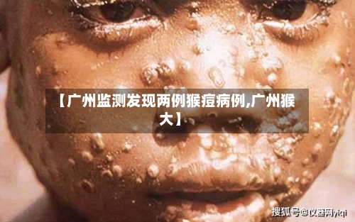 【广州监测发现两例猴痘病例,广州猴大】
