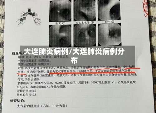 大连肺炎病例/大连肺炎病例分布-第2张图片